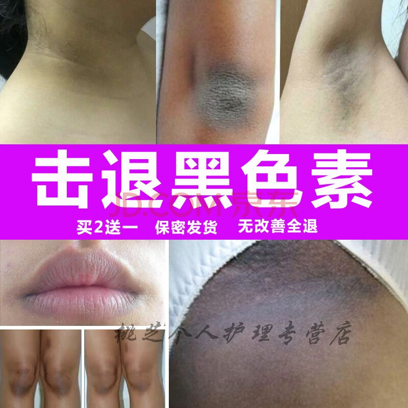 洗黑精华液脖子不干净颈部腋下腋窝大腿根脸部全身白去除黑色素沉淀