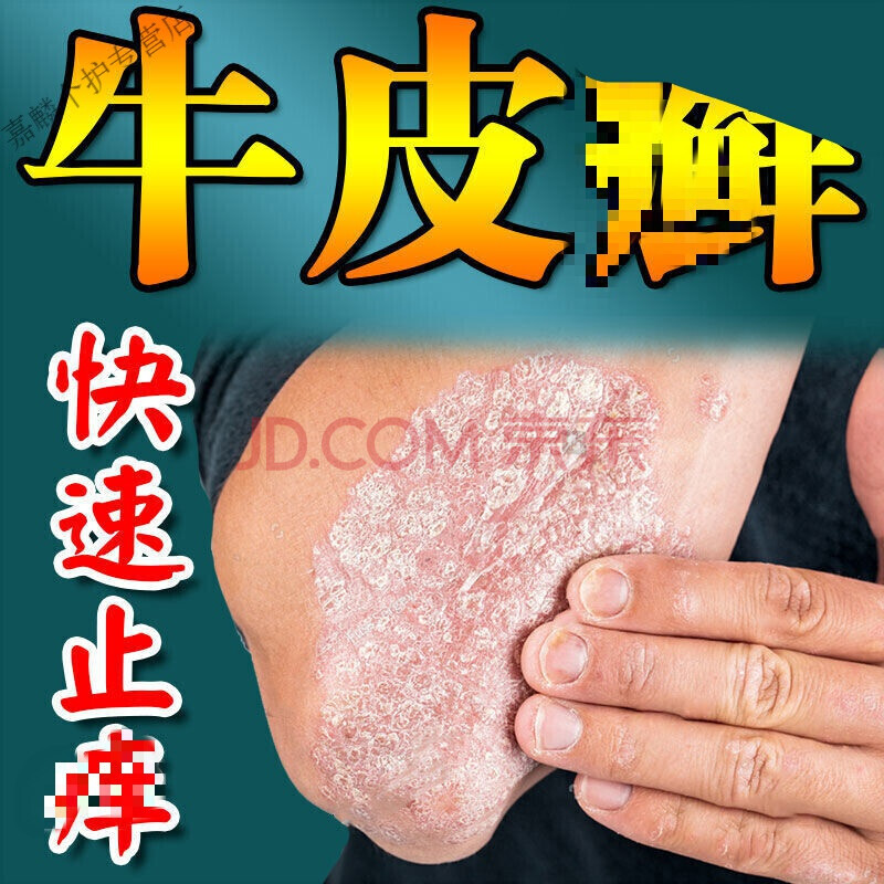 三珍清紫椒癣藓酊外用皮肤止养草本喷剂狼毒癣养灵癣克