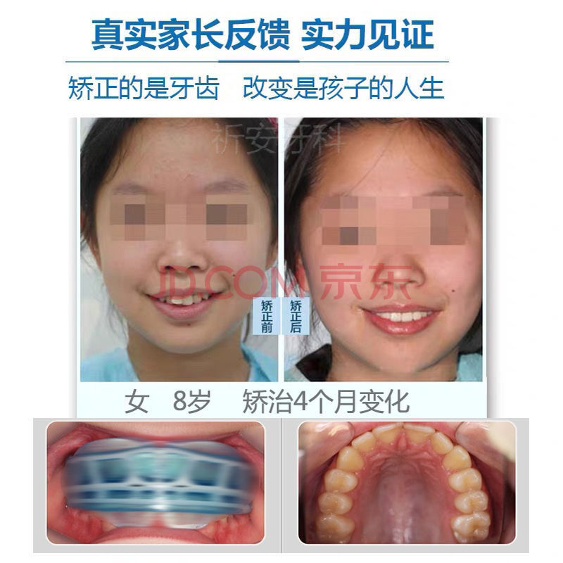 兒童牙套牙齒器隱形夜間磨牙齙牙地包天糾正不齊整牙澳洲 階段(小號)