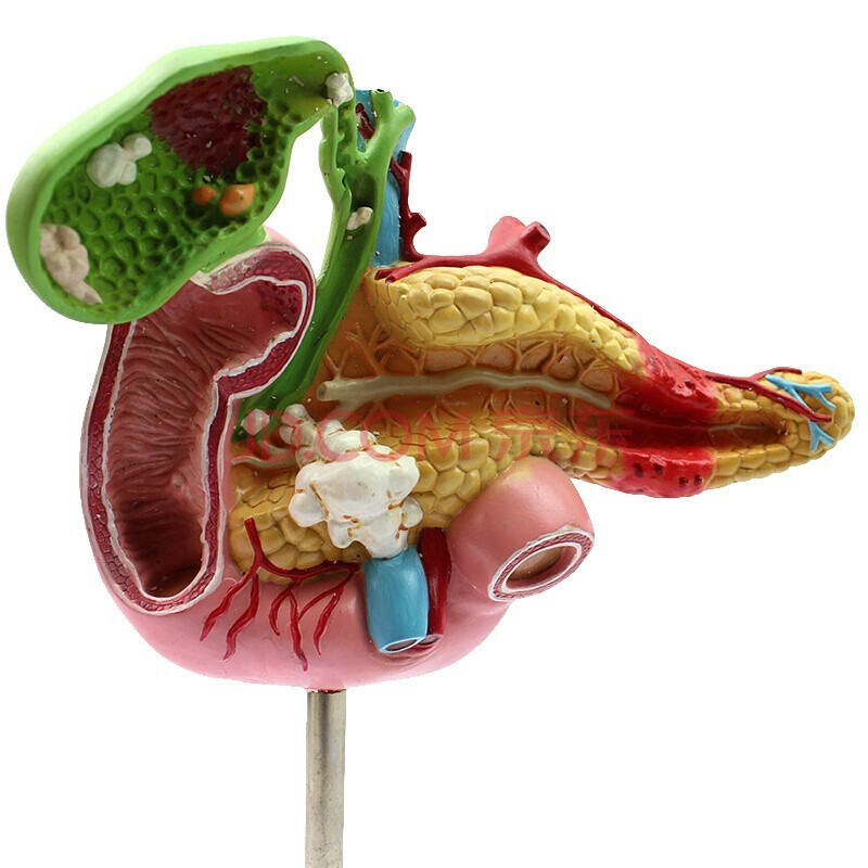 醫學胰腺十二指腸膽囊病理模型肛腸科消化內科大腸模型人體解剖消化道