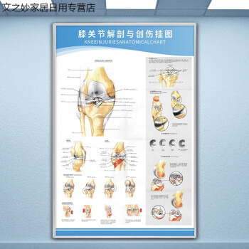 醫學足關節解剖示意圖人體結構解剖圖掛圖宣傳畫骨科宣傳健康海報 膝