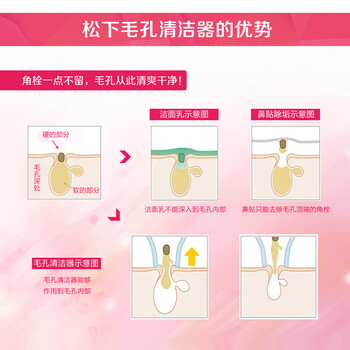 松下美容仪st50和st63（松下EH2513美容仪怎么样）