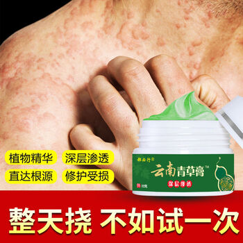 云南青草膏成人儿童快速止痒薬膏过敏身上痒皮l炎湿l疹荨l麻疹膏 云南