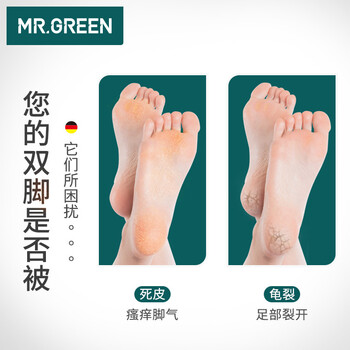 MR.GREEN德国双面搓脚板磨脚石去死皮老茧刮脚底后跟锉进口工具Mr-2205PR