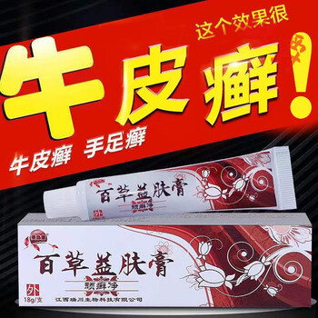 牛l皮l癣专用膏手l癣皮肤瘙痒湿l疹皮l炎瘙痒止痒股体l癣薬l膏顽固性