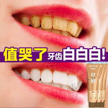 官方旗舰口益清刷白小苏打牙膏去牙渍美白牙齿去黄3只家庭装