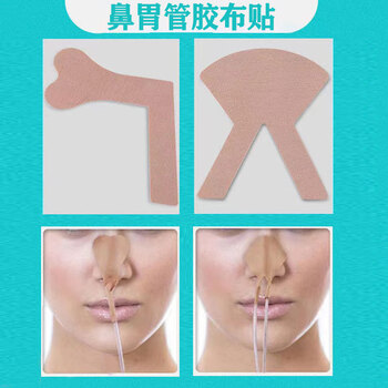 今天买明天到 导管固定贴鼻梁贴导管胃管胶带固定胃管鼻饲管鼻贴鼻饲胶布贴v型l型10片装l型10片 平均2 9 片 当次日达 图片价格品牌报价 京东