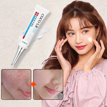 祛痘膏学生男女士芦荟胶青春痘印淡坑粉刺霜螨虫祛痘凝露一支祛痘克星