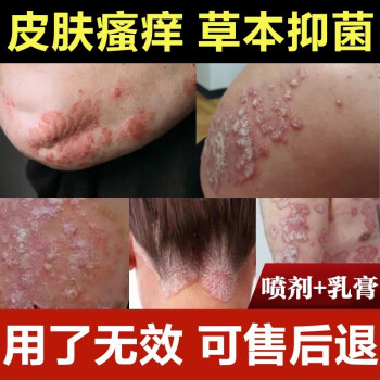 法意蘭雲南本草皮膚溼癢膏大腿內側肛門陰囊潮溼皮膚瘙癢1套組合裝20g