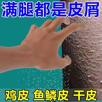 鸡皮肤救星鱼鳞皮肤霜鸡皮疙瘩皮肤干燥粗糙起皮润肤身体乳磨砂膏购2