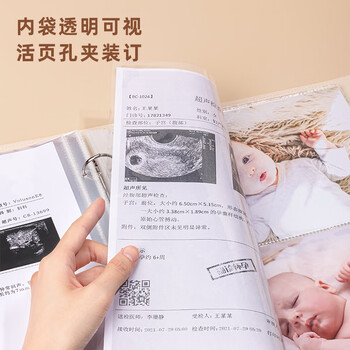 得力（deli）产检收纳册孕检报告单孕妈妈资料袋孕期怀孕记录册活页本便携b超a4+a5体检单蓝色PQ901-E