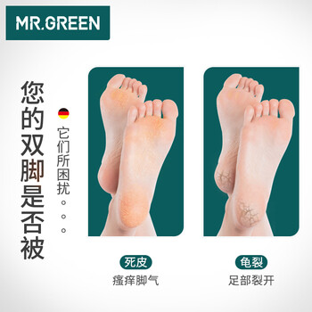 MR.GREEN德国双面搓脚板磨脚石去死皮老茧刮脚底后跟锉进口工具Mr-2205OR