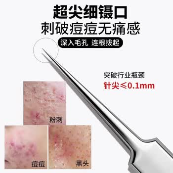 领臣粉刺针细胞夹3件套镊子黑头夹粉刺夹暗疮针挤痘痘神器
