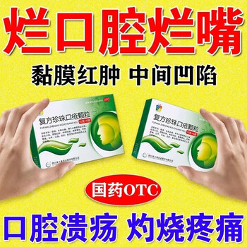 口腔溃疡吃什么药 治口疮药 嘴巴上火起泡口角炎唇干裂烂嘴角舌头溃疡