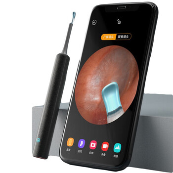 检耳镜可视挖耳勺采耳镜医用放大耳鼻喉科看耳朵工具耳道内窥镜家用