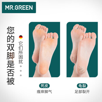 MR.GREEN德国双面搓脚板磨脚石去死皮老茧刮脚底后跟锉进口工具Mr-2205RD