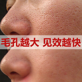 兰恬纪绿茶冰肌泥膜清洁泥膜清爽补水保湿控油男女火山绿豆泥面膜1瓶