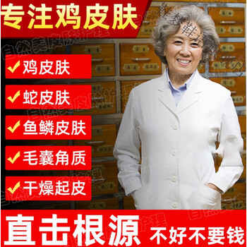 鸡皮肤去医院要多少钱(正规医院皮肤科可以治疗鸡皮肤吗) 鸡皮肤去医院要多少钱(正规医院皮肤科可以治疗鸡皮肤吗)