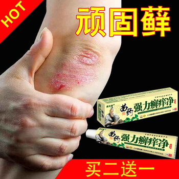 牛皮丨藓鲜银i屑i病专治i疗头皮手足脚体股i鲜廯水泡皮肤外用癣膏箹