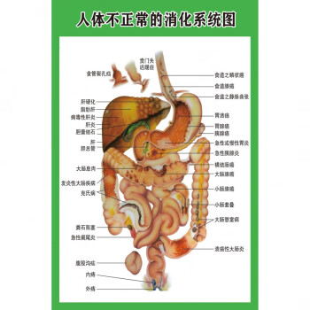 五脏六腑淋巴示意解刨器官挂图 人体不正常的消化 80*120厘米=48寸