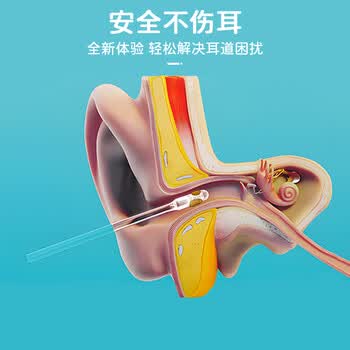 秉优 粘耳棒96个装 掏耳朵神器挖耳勺儿童黏耳棒不伤耳一次性掏耳 秉优 粘耳棒96个装 掏耳朵神器挖耳勺儿童黏耳棒不伤耳一次性掏耳