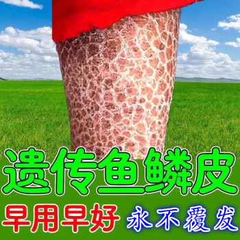 去魚鱗皮成功魚鱗蛇皮膚剋星保溼美i白蛇皮膚修復身體乳單盒裝單品去