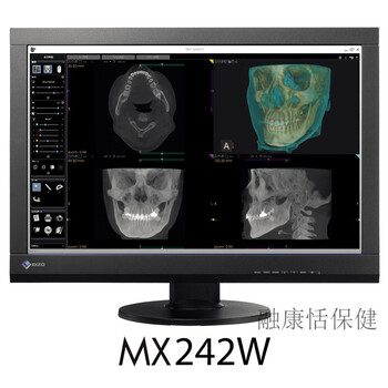 诊断医用显示器 EIZO艺卓 MX241W MX242W 24寸2M医用DR竖屏牙科CT诊断显示 EIZO MX241W CCFL背光 套餐一 ...