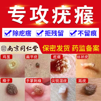 去疣膏搭疣瘊净咪喹丨莫特乳膏去疣灵尖锐湿疣除肉粒刺猴跖疣扁平疣 一盒装(适合轻微少量型)【图片 价格 品牌 报价】-京东