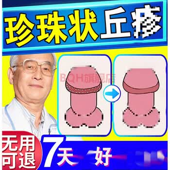 nhfouyou冠状沟珍珠l疹阴l茎珍珠l状疹珍珠l疹男性男士生殖器冠状沟