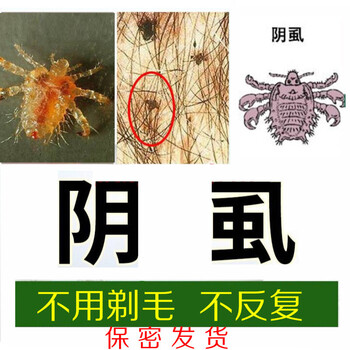 10%硫磺软膏阴虱无踪通济t克虱露手脚小水泡脱皮痒阴囊瘙痒皮肤疥虫 1