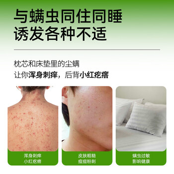 满婷(MANTING)青花椒清螨除菌喷液248ml*2(除螨喷雾剂床上免洗免晒杀菌抑菌) 满婷(MANTING)青花椒清螨除菌喷液248ml*2(除螨喷雾剂床上免洗免晒杀菌抑菌)