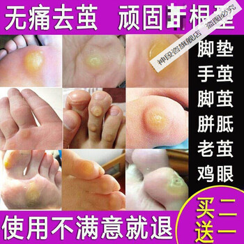 官方旗舰脚底老茧去除膏硬死皮软化剂脚茧子去除治脚垫的胼胝贴足部