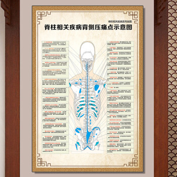 示意圖脊椎相關疾病背側壓痛點示意圖60x90釐米36寸油畫布藝術感強