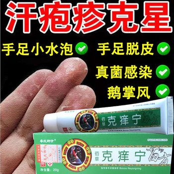 手i藓气季节性手掌脱皮修复霜手指头痒起水泡开干皲裂皮肤止痒膏 三