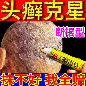 頭皮瘙癢頭皮l癬抑菌乳膏牛皮l癬頭皮脂溢性皮l炎頭皮銀l屑病毛囊炎