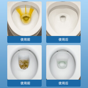 vilosi卫洛仕尿碱溶解剂马桶清洁剂厕所尿垢草酸除垢剂洁厕剂洁厕灵300g