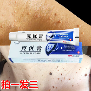 疣必清尖锐湿疣克优膏疣瘊净疣瘊肉粒一抹无忧鸦胆子祛优疣膏疣必治