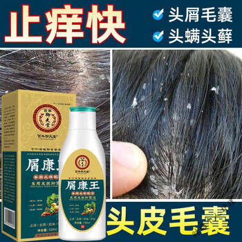 毛囊炎洗发水头皮头x癣溢脂性皮p炎红i斑疙瘩脓包止痒去屑控油洗发水