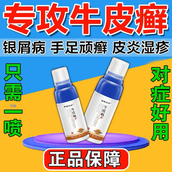 牛皮癣专用的药顽固牛皮癣银i屑病外用喷剂成人股癣手足癣瘙痒难 单