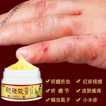 疥l疮膏疥l疮结节一扫光薬硫磺软膏祛阴虱螨虫皮肤私处瘙痒薬膏单瓶装