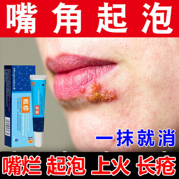 嘴角起泡烂嘴角起水泡嘴巴脓疮嘴巴上火口角红肿发痒溃烂上火起泡唇