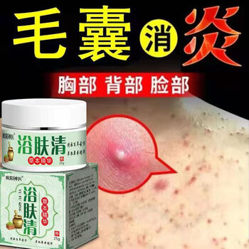 什么药可以治的鸡皮肤(什么药物可以治疗鸡皮肤)