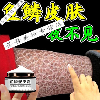 三天好祛鱼鳞皮肤鱼鳞皮肤霜干燥纹路病起皮修复身体乳巩固装5盒买三
