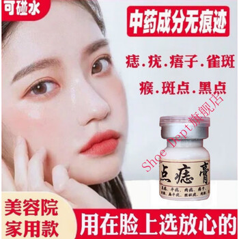 薬膏脸部去黑点脸部专用无痕去黑痣除痣脸部痦子瘊l子雀斑点痣膏1瓶