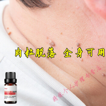 丝状尤疣去除膏脖子小肉粒疙瘩颈部扁平尤治皮赘肉次刺瘊猴子疣瘊净
