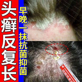 治头癣头皮癣专用药膏头皮痒脂溢性皮炎毛囊炎头部专用药银屑头皮屑头上长红疙瘩真菌感染 硝酸咪康唑乳膏 1盒头皮瘙痒【图片 价格 品牌 报价】-京东
