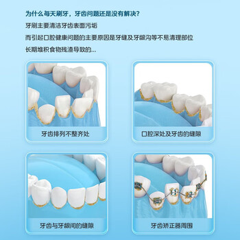 美的（Midea）冲牙器  水牙线 预防牙结石家用便携洗牙器 MC-BJ0102蓝色