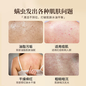 力仕康硫磺皂除螨沐浴露祛螨虫背痘控油止痒杀菌止痒洗头洗脸洗澡三合一