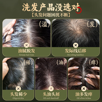 KOOGIS侧柏叶洗发皂洗发水手工香皂角何首乌中草药洗头护发包黑发乌发皂