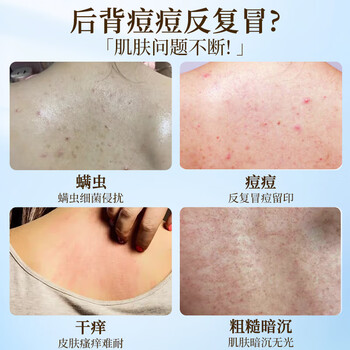 力仕康硫磺除螨沐浴露液体香皂清爽控油止痒洗头洗脸洗澡三合一男女专用 力仕康硫磺除螨沐浴露液体香皂清爽控油止痒洗头洗脸洗澡三合一男女专用